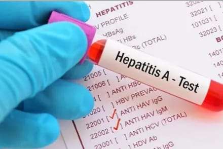 Aumento de casos de Hepatitis A en el pais